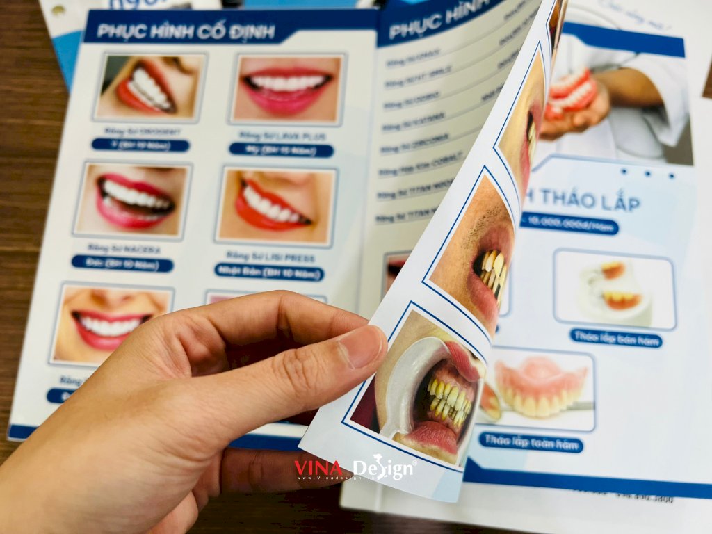 In menu bảng giá dịch vụ nha khoa, in cuốn menu bìa cứng đóng ghim inox - VINADESIGN